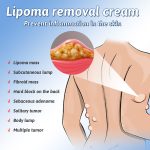 Lipoma Removal Spray - 2 File (ফুল কোর্স) - Image 2