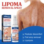 Lipoma Removal Spray - 2 File (ফুল কোর্স) - Image 3